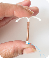 copper IUD